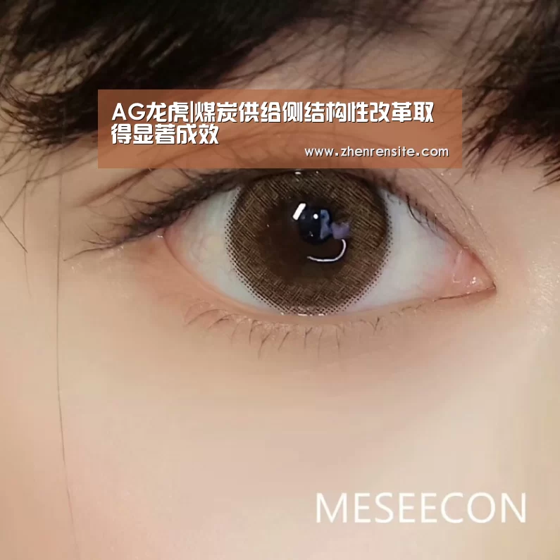 AG龙虎|煤炭供给侧结构性改革取得显著成效(图1) AG真人